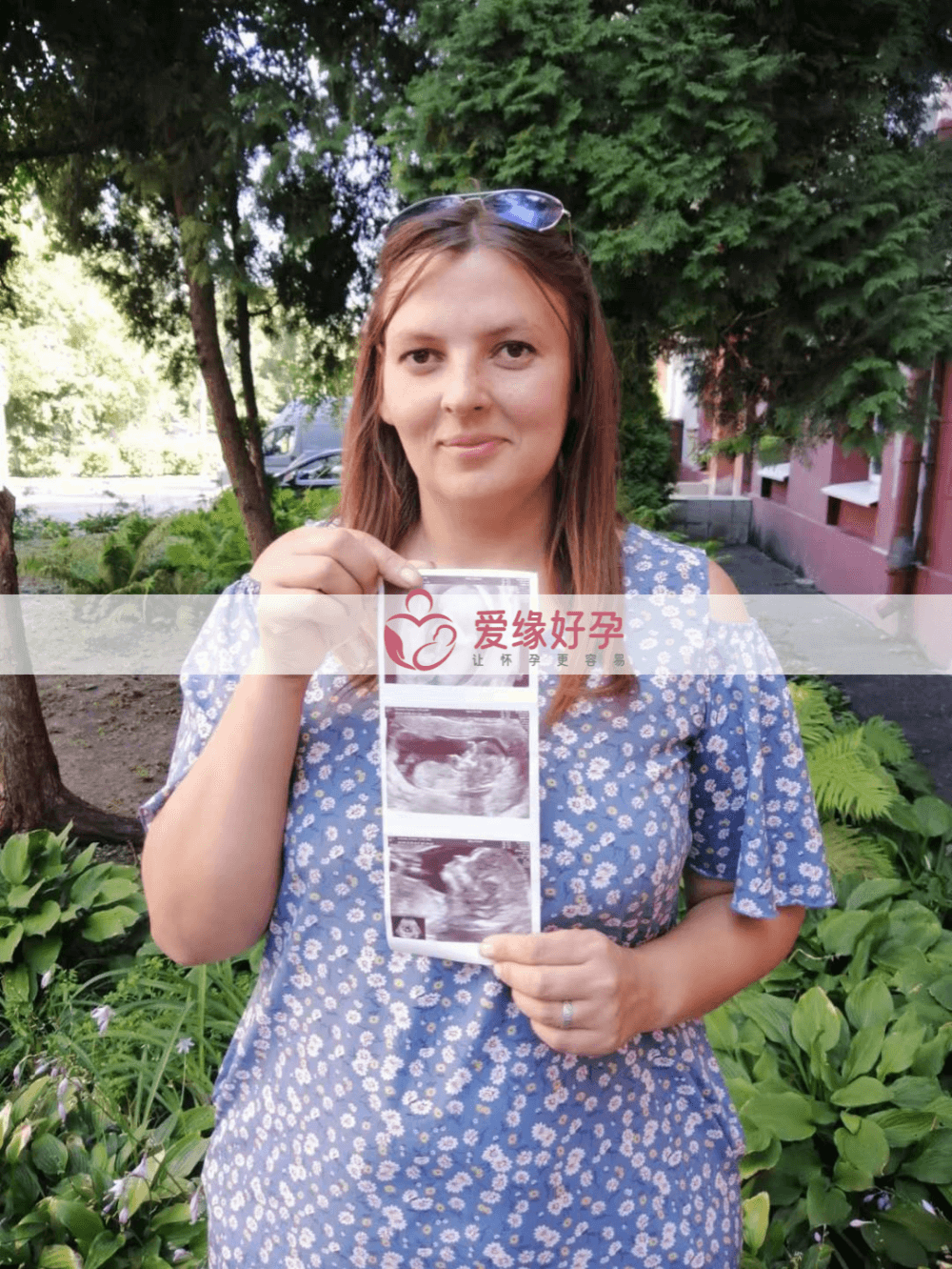 哈萨克斯坦乌克兰试管助孕代孕代母13周NT检查顺利通过