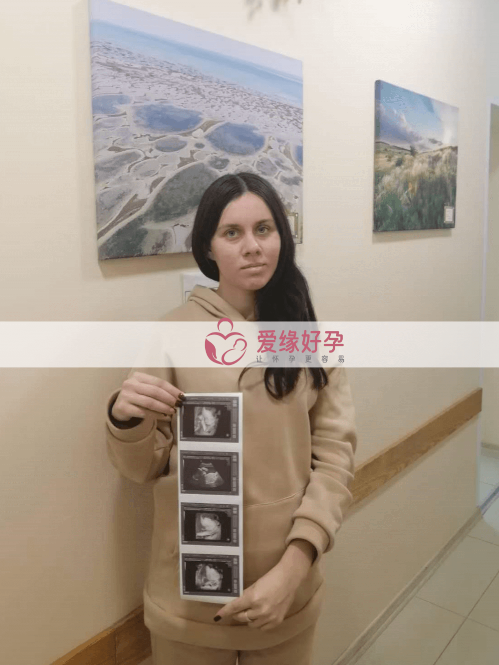 哈萨克斯坦乌克兰代孕代孕代母23周产检顺利通过