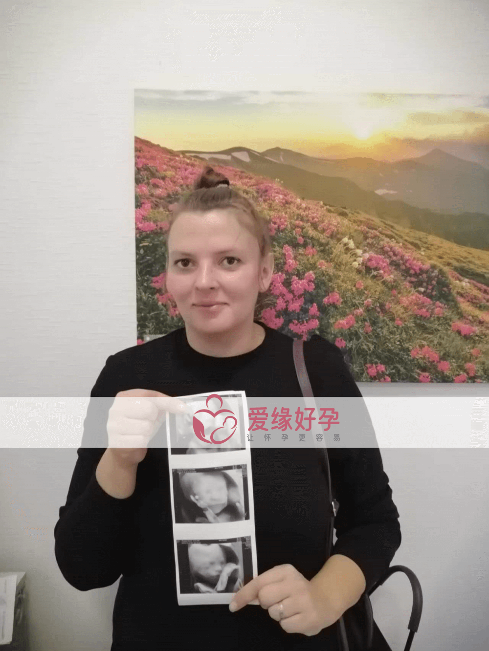哈萨克斯坦乌克兰代孕代孕代母24周产检通过！