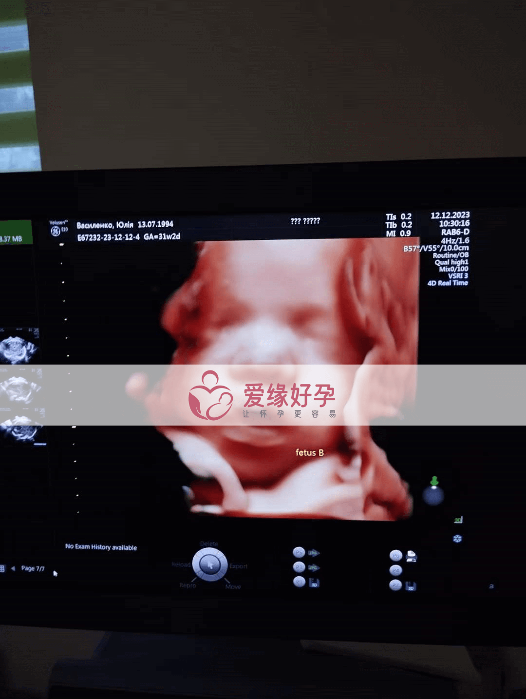 乌克兰代孕代孕代母孕29周产检顺利通过
