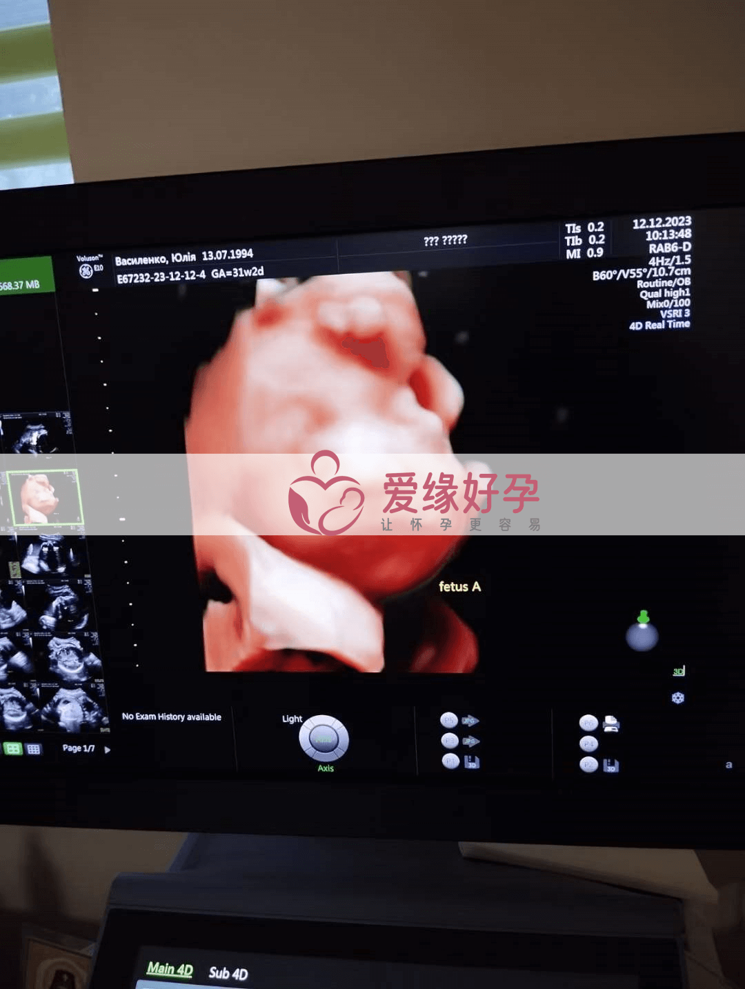 乌克兰代孕代孕代母孕29周产检顺利通过