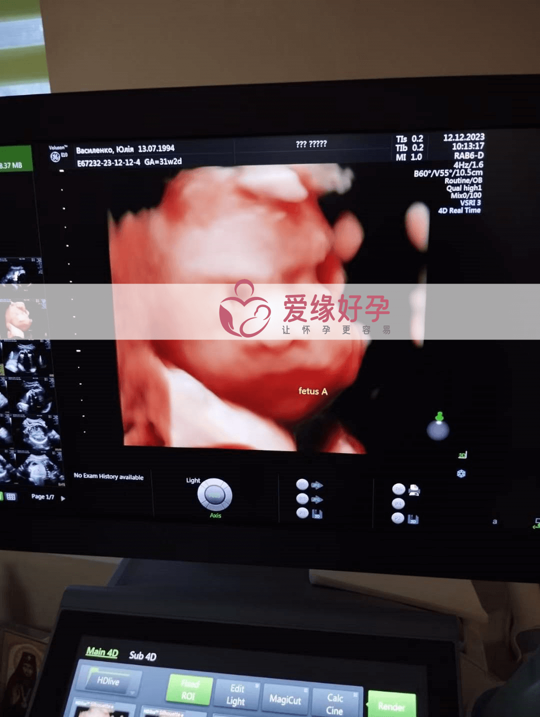 乌克兰代孕代孕代母孕29周产检顺利通过