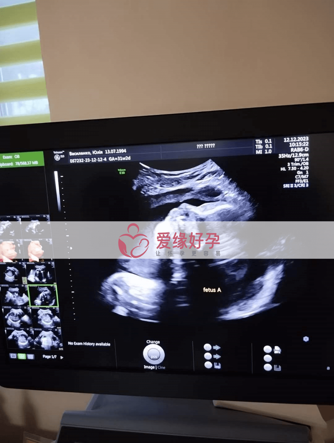 乌克兰代孕代孕代母孕29周产检顺利通过