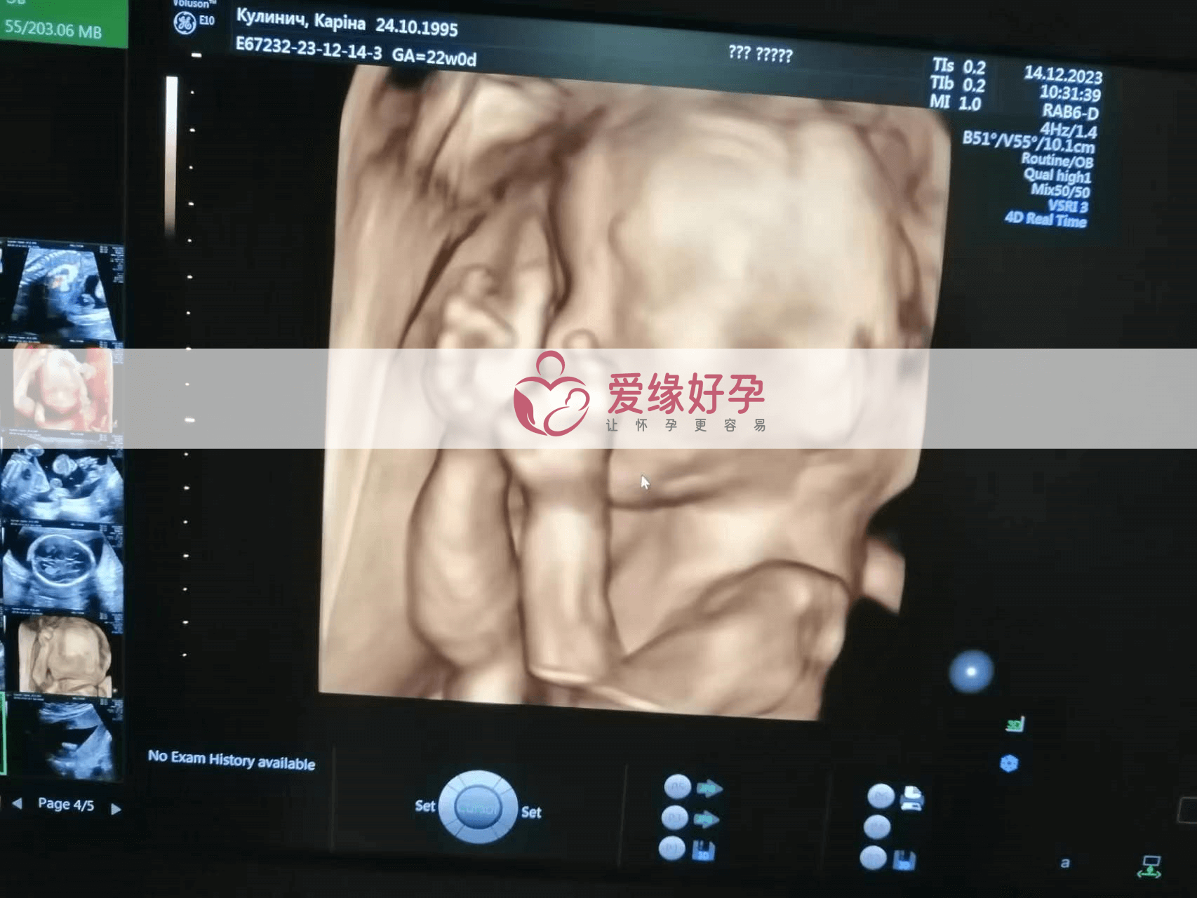乌克兰代孕代孕代母20周产检顺利通过！