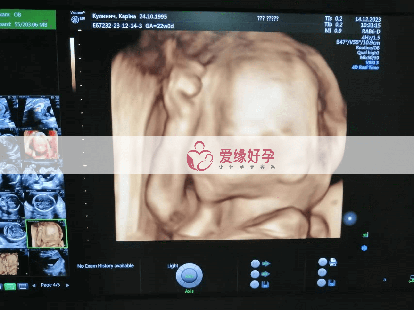 乌克兰代孕代孕代母20周产检顺利通过！