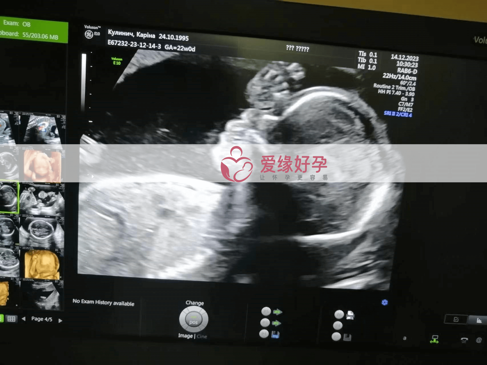 乌克兰代孕代孕代母20周产检顺利通过！