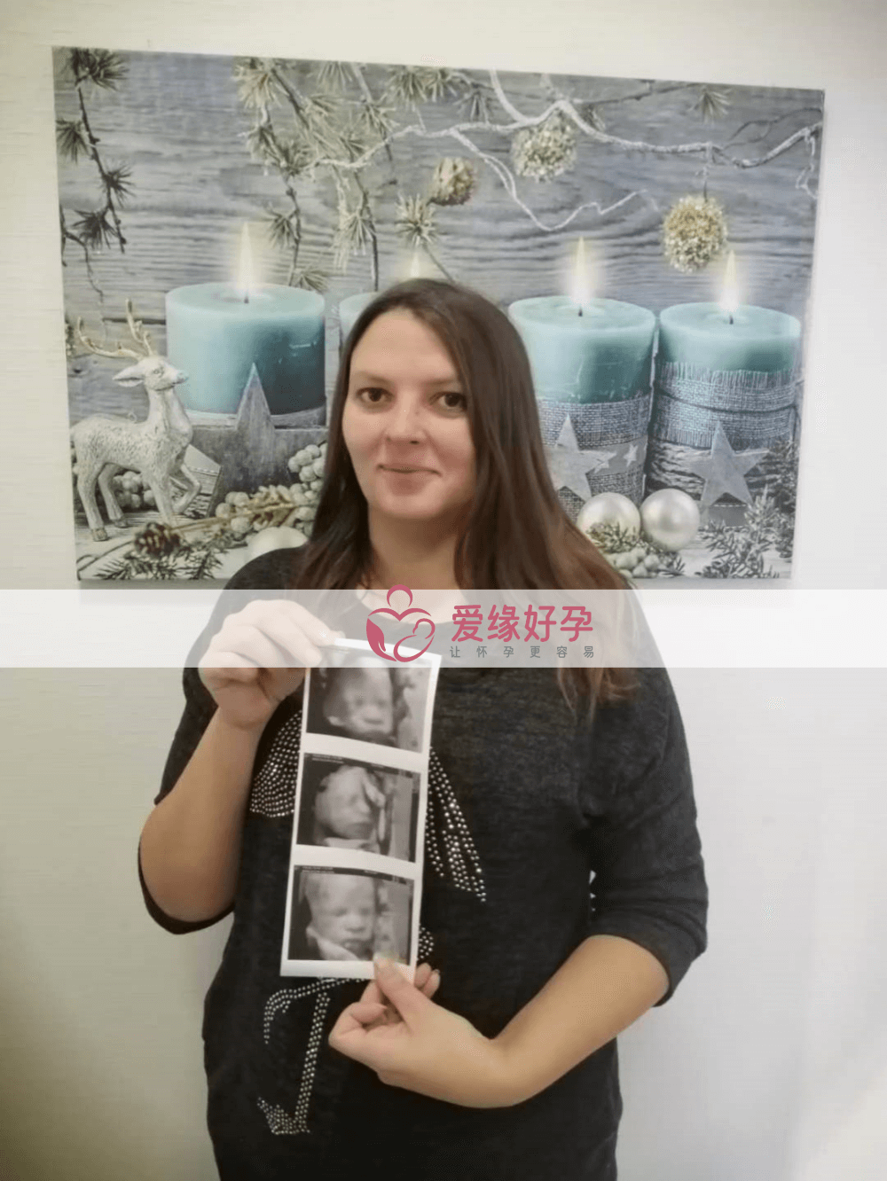 乌克兰哈萨克斯坦代孕代孕代母28周产检通过！