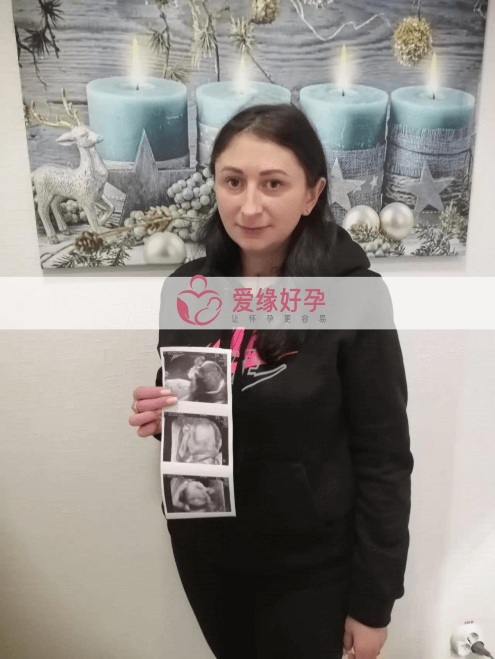 乌克兰代孕代孕代母20周产检顺利通过！