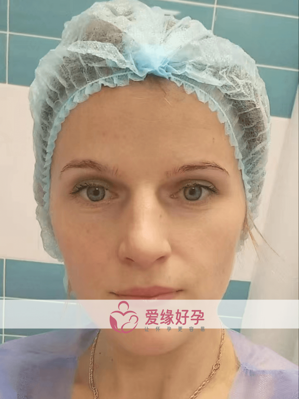 乌克兰代孕孕母在乌克兰MC医院移植一颗囊胚