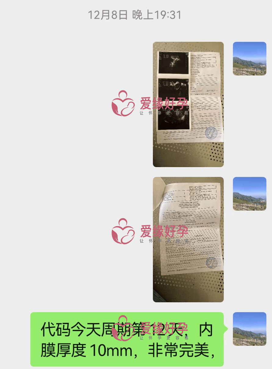 爱缘好孕:南京客户哈萨克斯坦代孕移植一次成