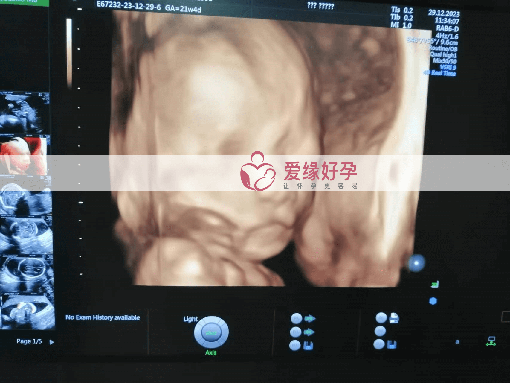 爱缘好孕:代孕代孕代母21周产检顺利通过