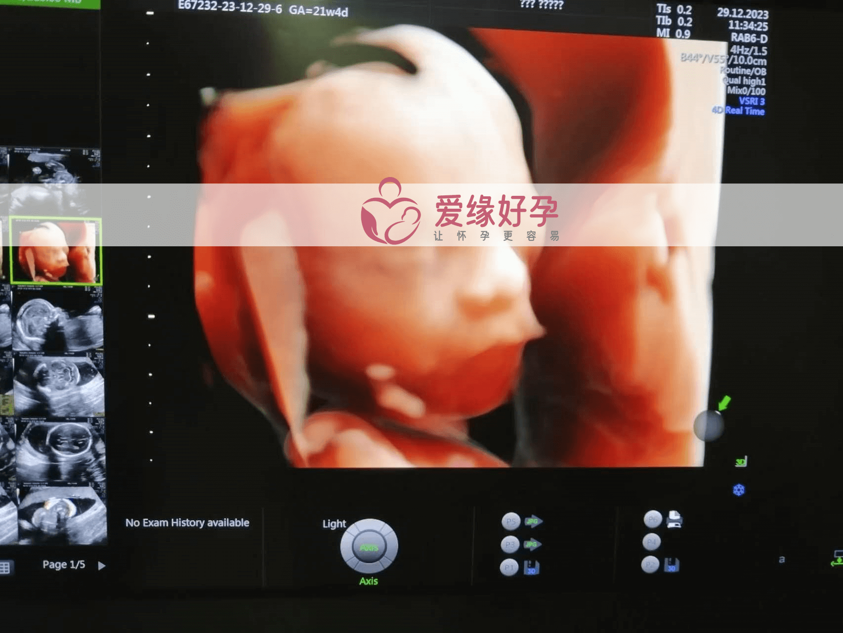 爱缘好孕:代孕代孕代母21周产检顺利通过