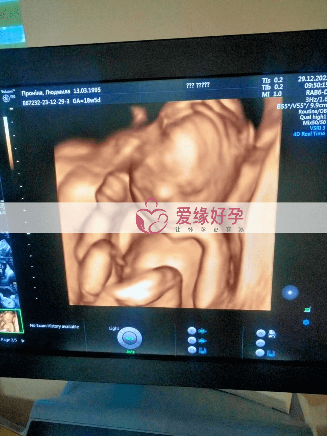 爱缘好孕:代孕代孕代母18周产检顺利通过