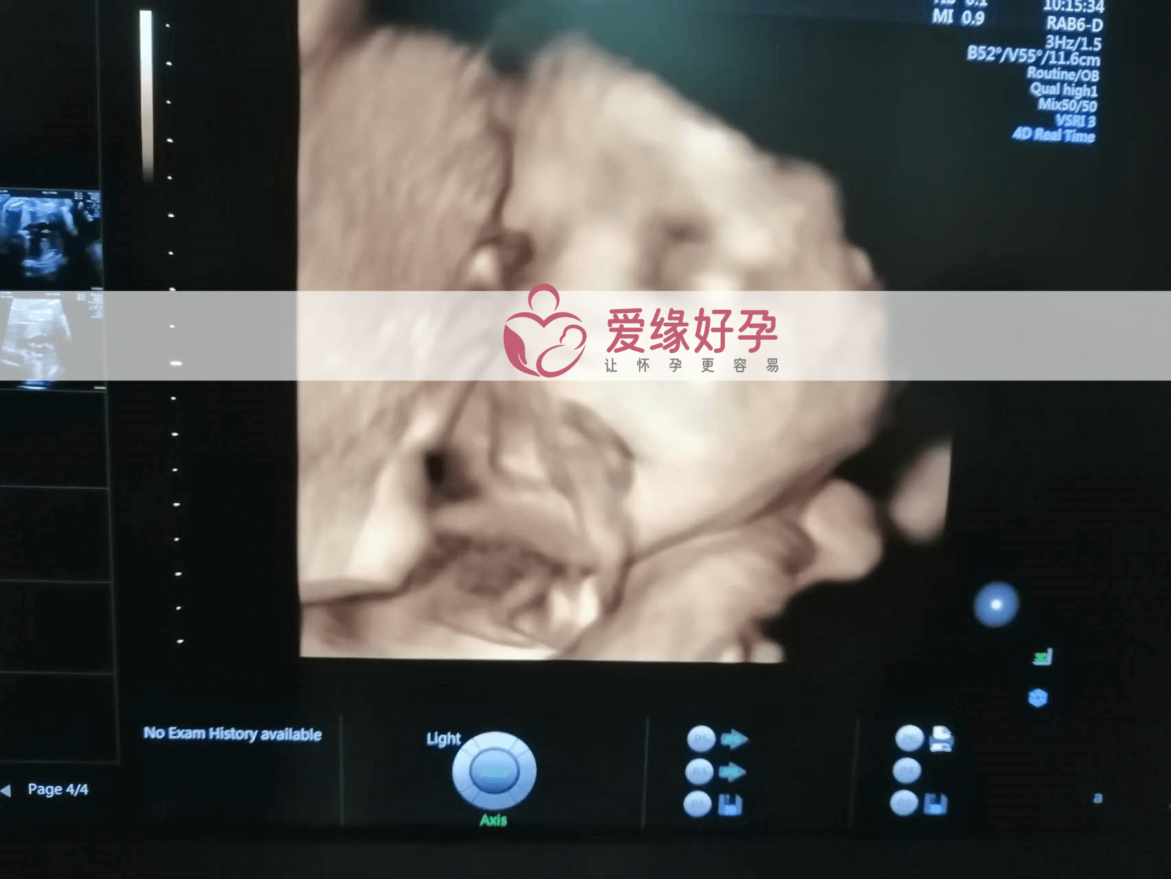 代孕代母代孕33周产检顺利通过