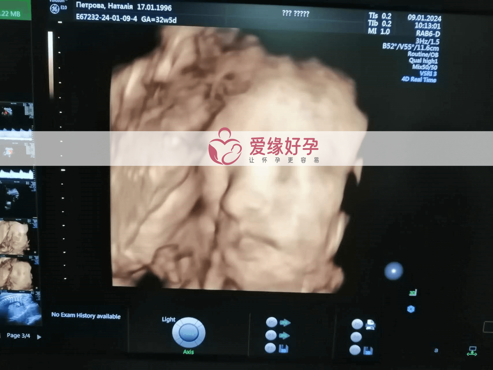 代孕代母代孕33周产检顺利通过