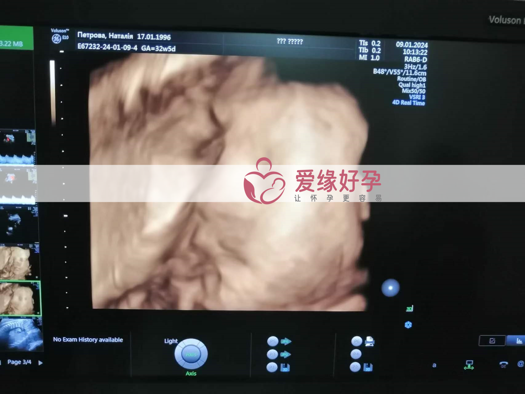 代孕代母代孕33周产检顺利通过