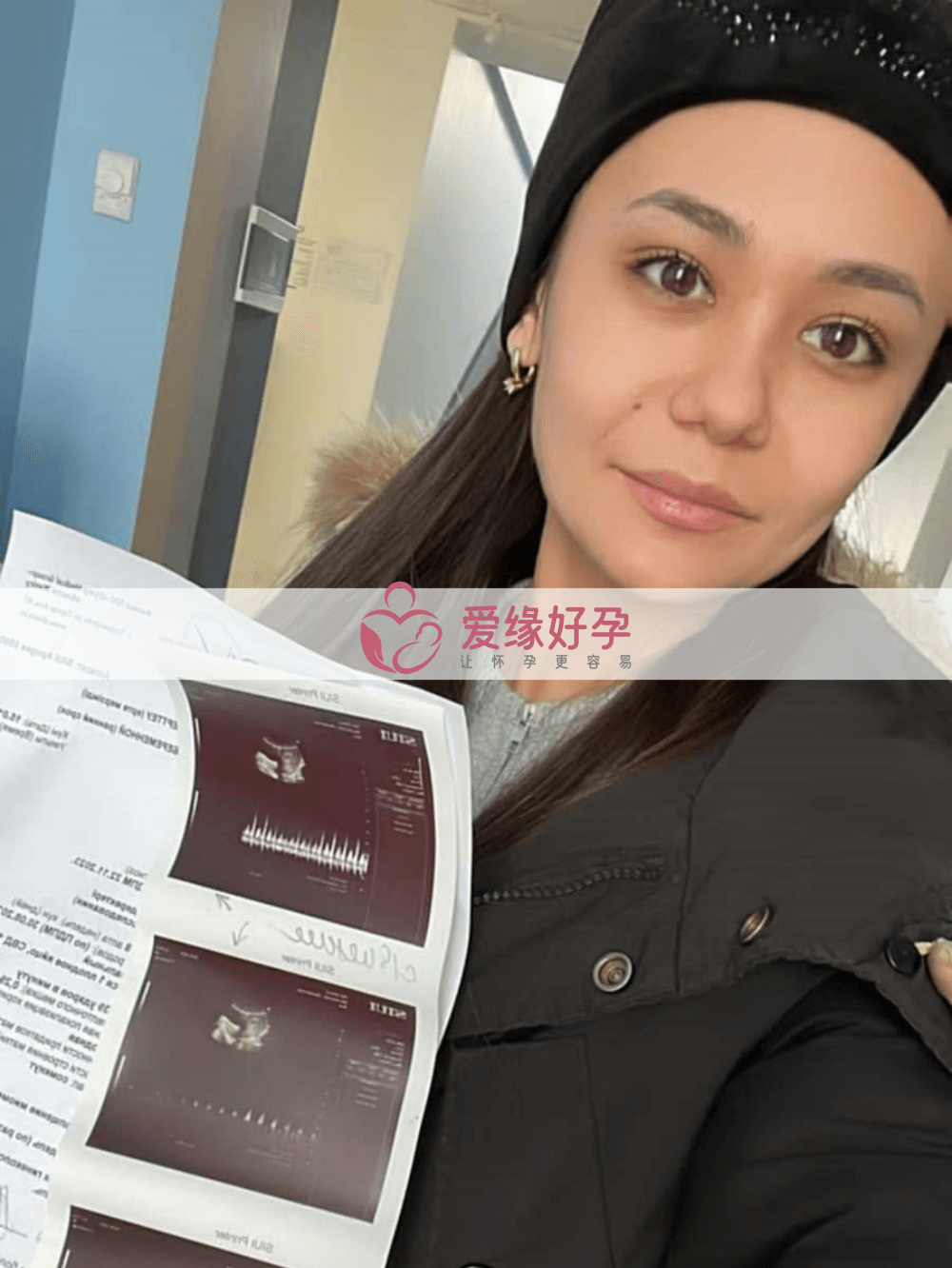 哈萨克斯坦代孕第一次B超检查通过
