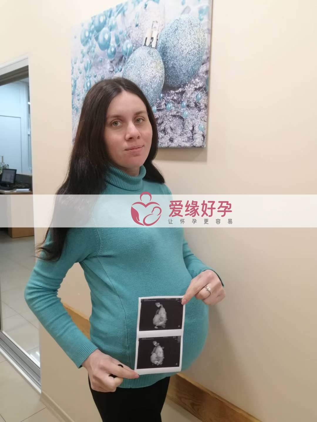 哈萨克斯坦试管婴儿助代母妈35周产检顺利通过