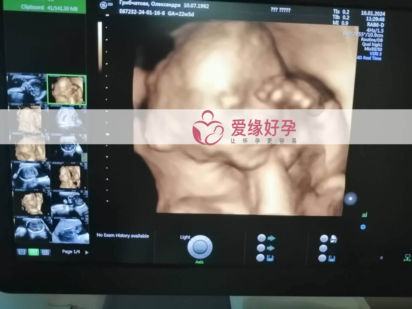 哈萨克斯坦试管婴儿助代母妈23周产检顺利通过