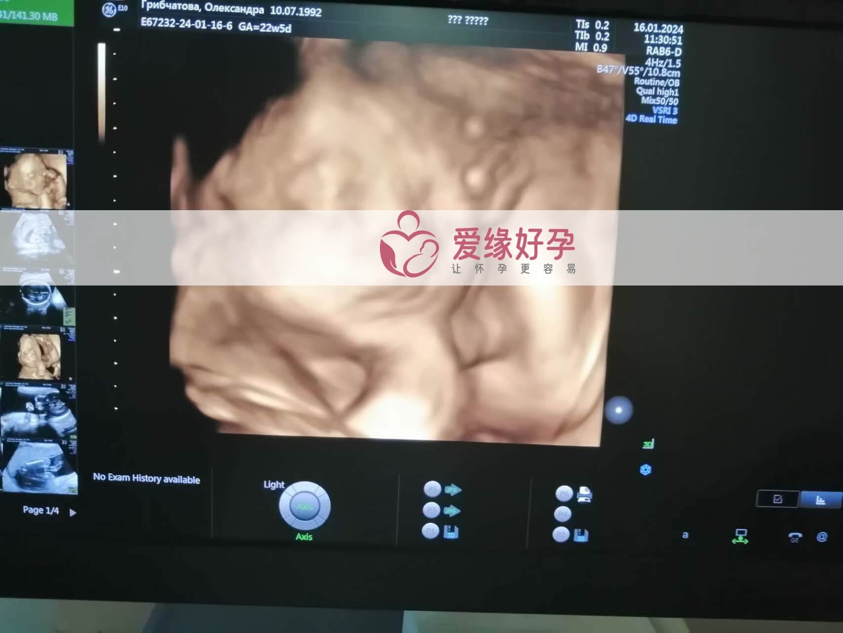哈萨克斯坦试管婴儿助代母妈23周产检顺利通过