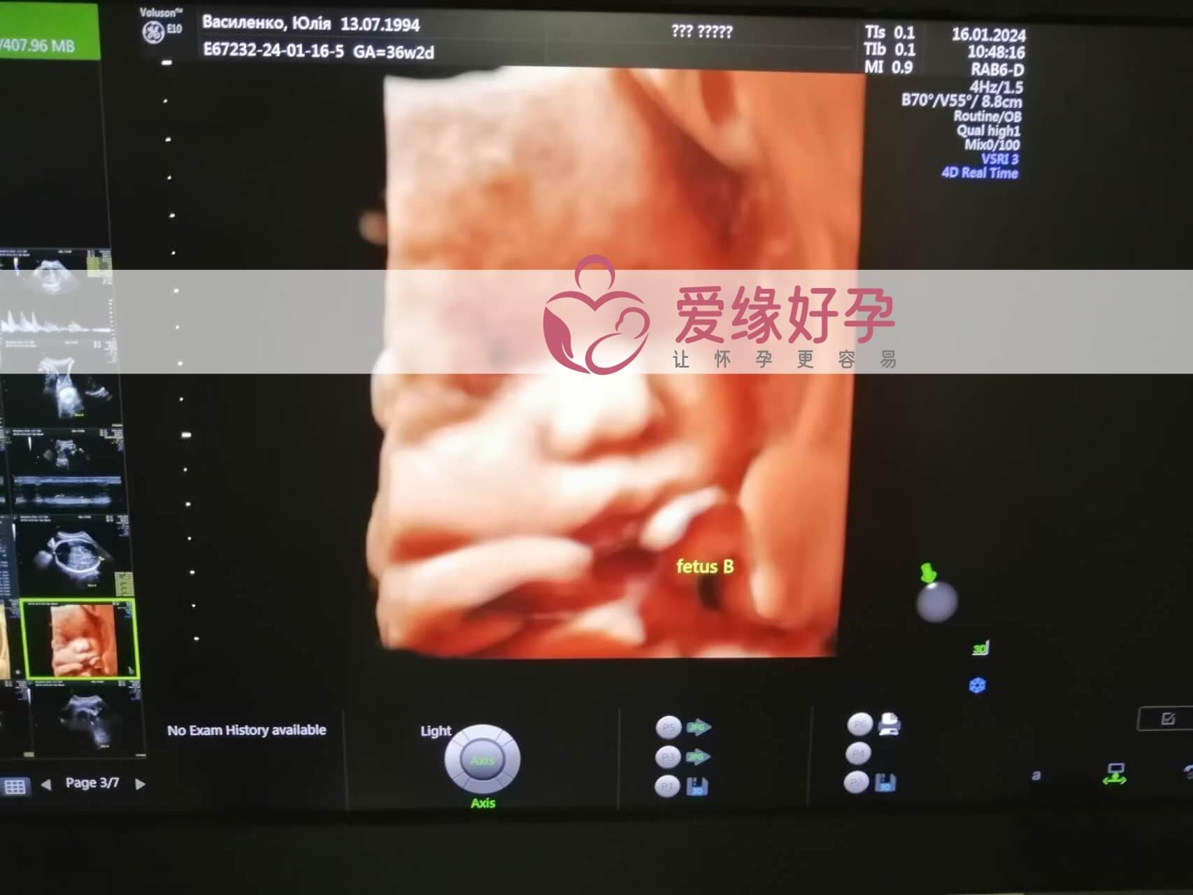 哈萨克斯坦试管婴儿助代母妈34周产检通过