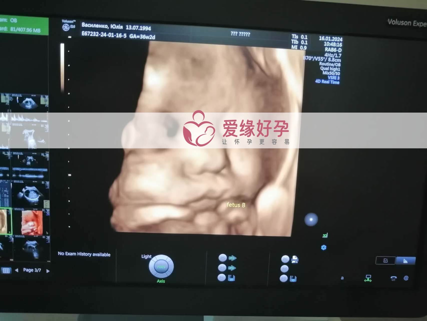 哈萨克斯坦试管婴儿助代母妈34周产检通过