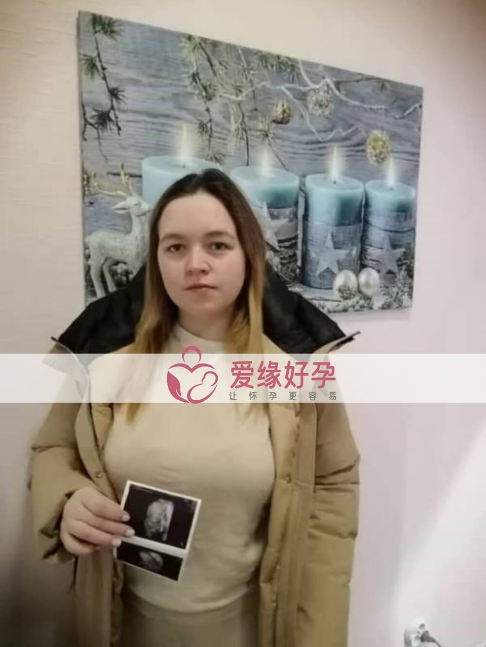 哈萨克斯坦试管婴儿助代母妈22周产检通过