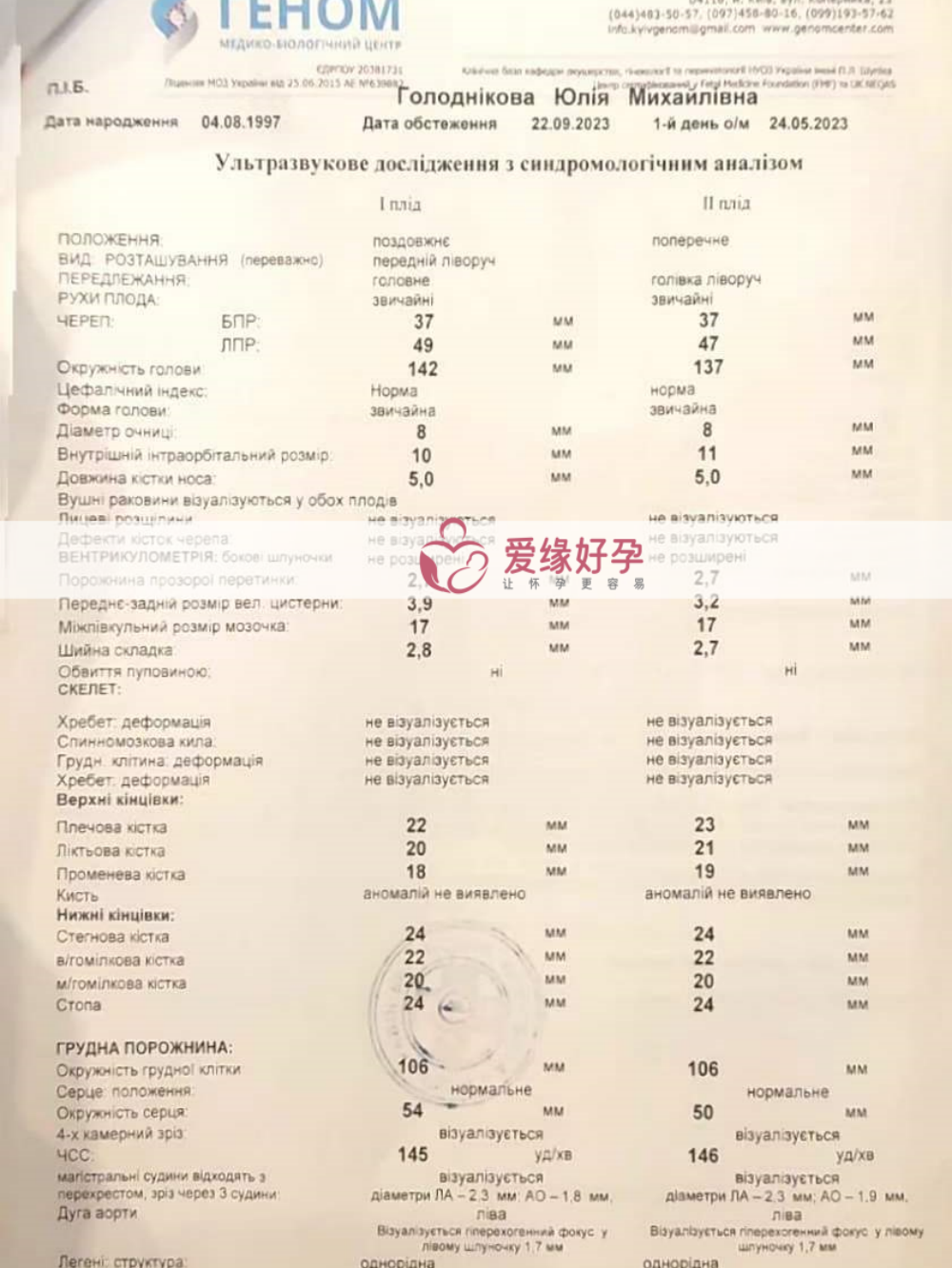 台湾委托父母同卵双胞胎17周检查顺利通过！