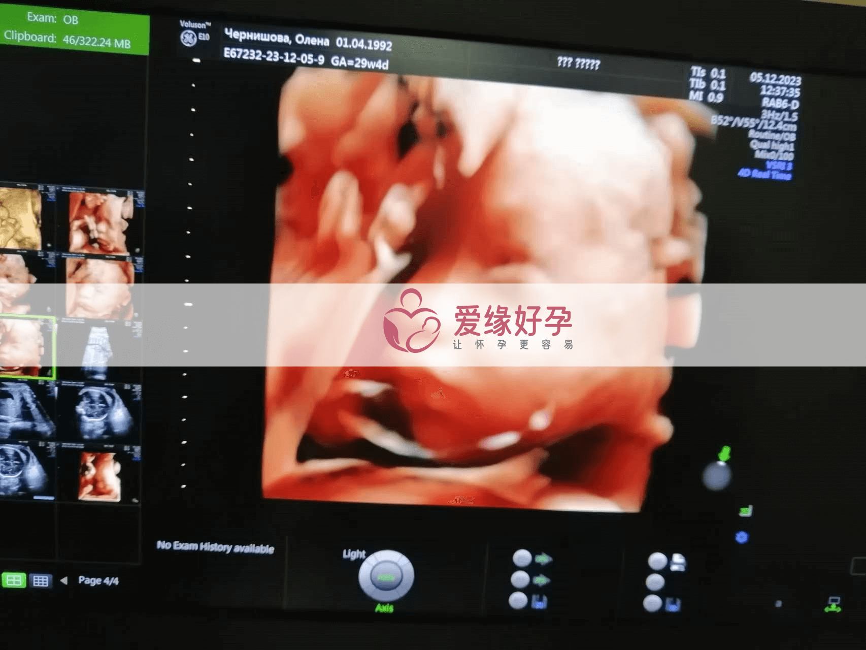 乌克兰代孕代孕代母29周产检通过!