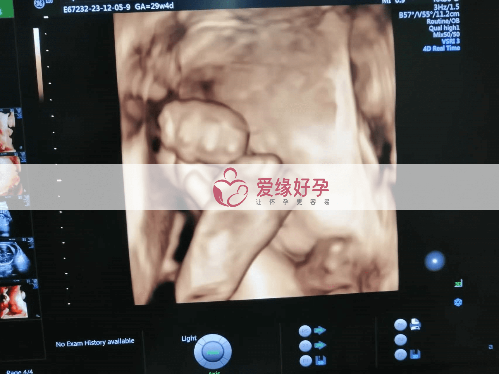 乌克兰代孕代孕代母29周产检通过!