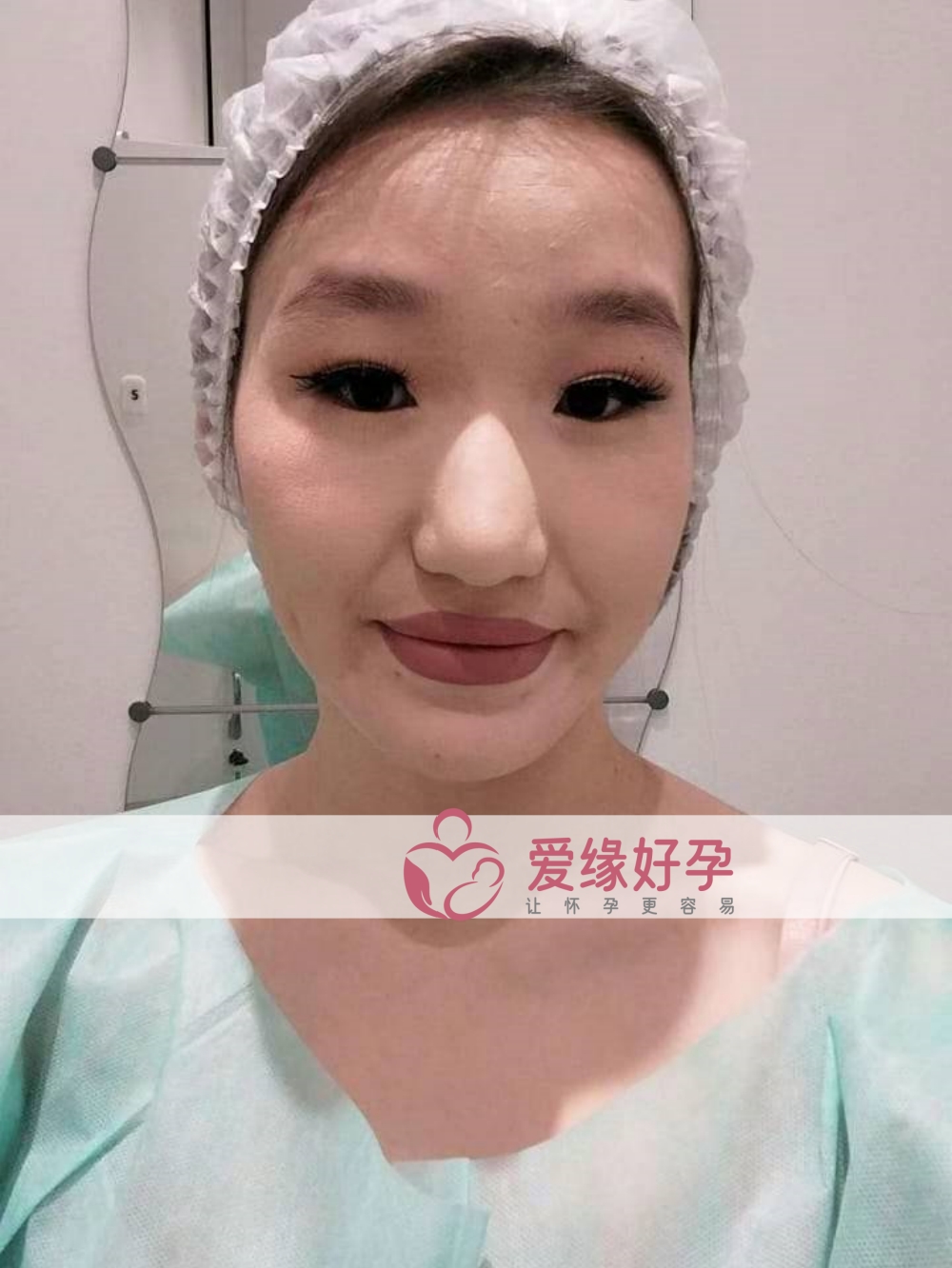 哈萨克斯坦试管婴儿助代母妈今天移植一颗囊胚