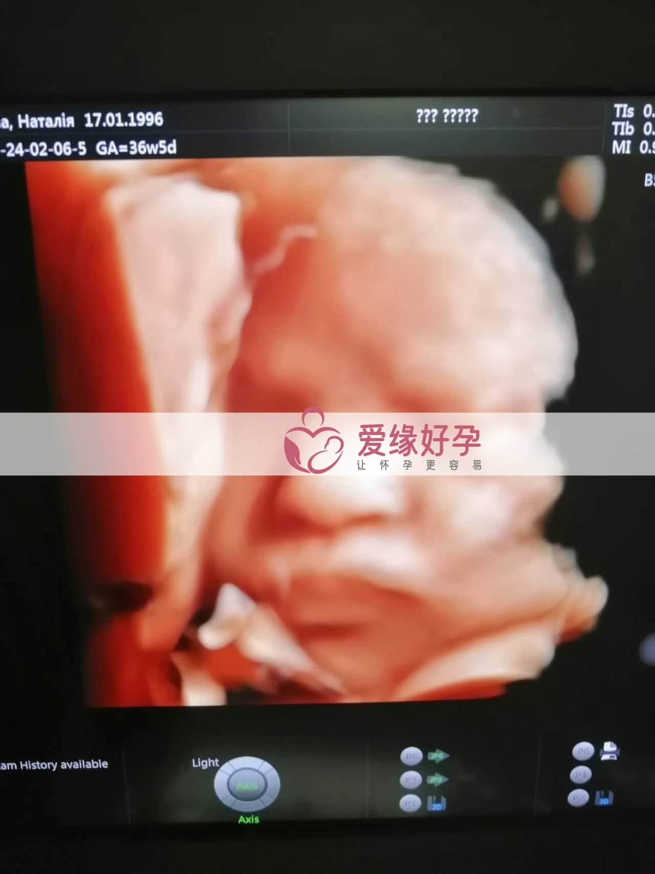 代孕代孕代母36周产检顺利通过