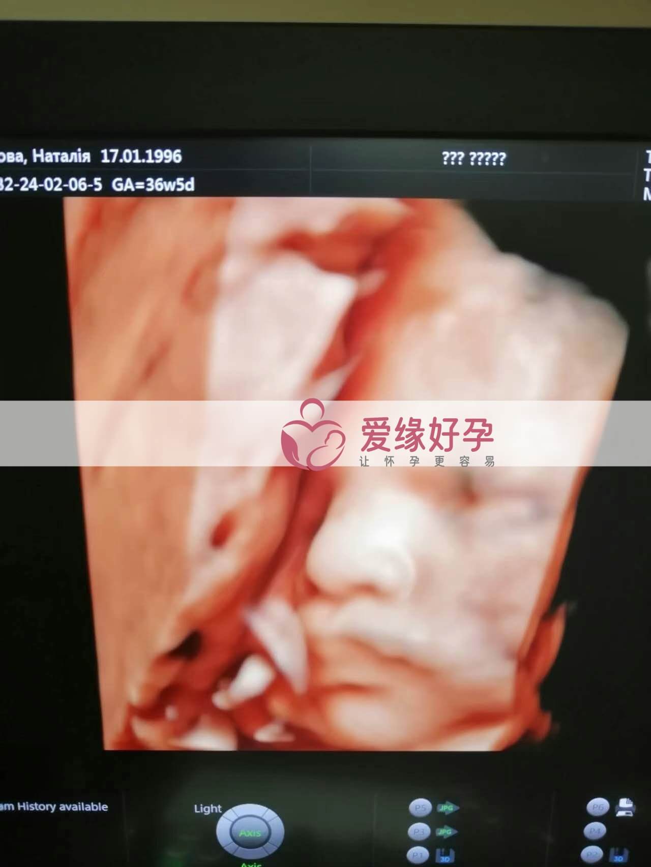 代孕代孕代母36周产检顺利通过