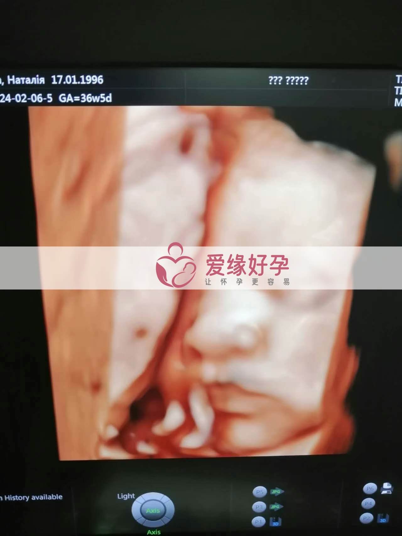 代孕代孕代母36周产检顺利通过
