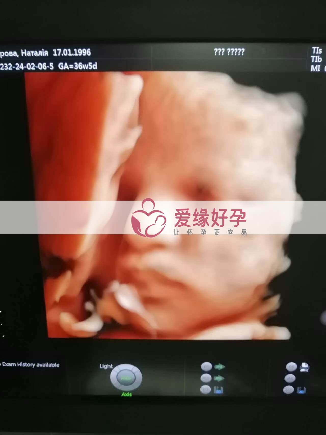 代孕代孕代母36周产检顺利通过
