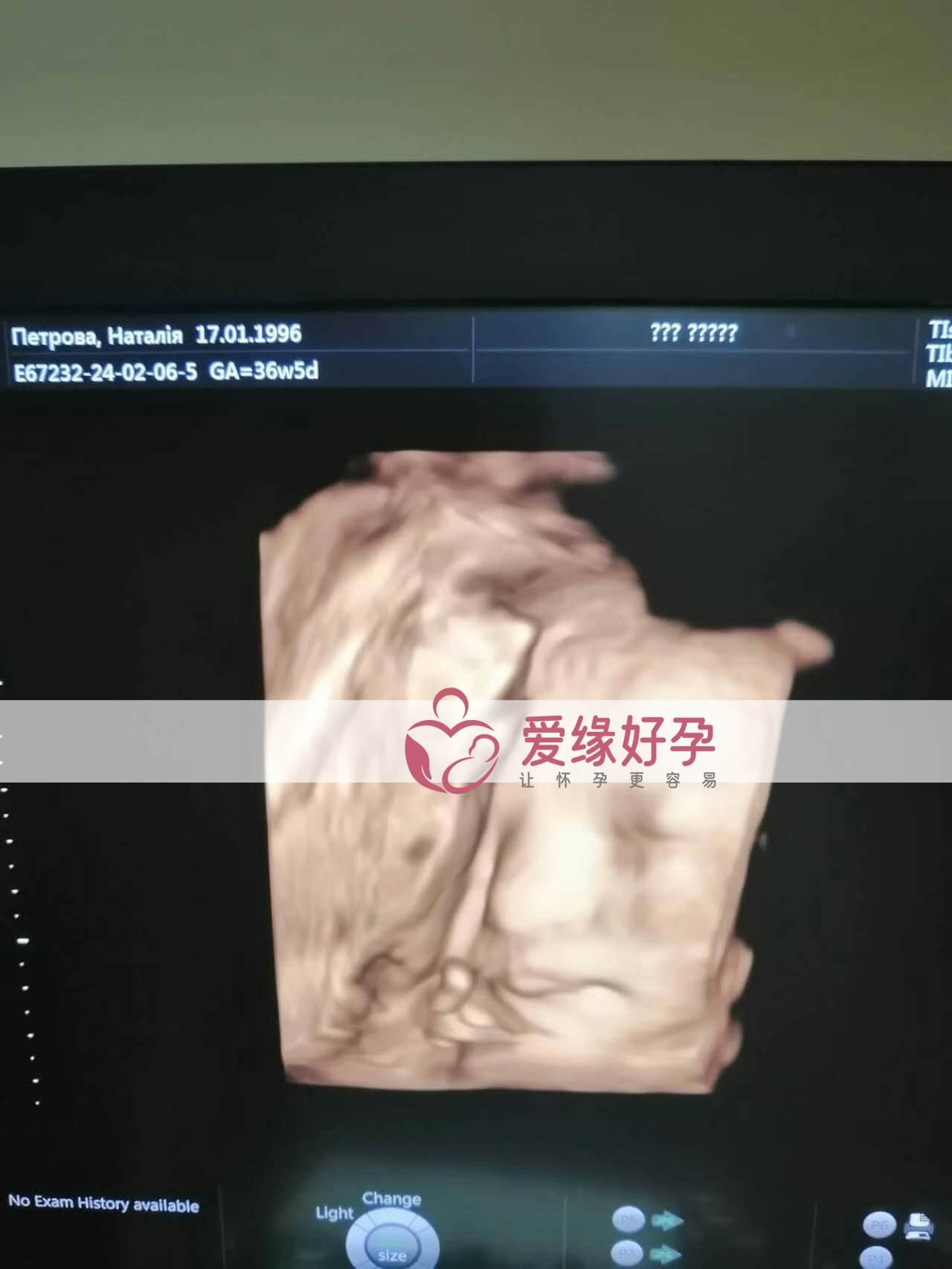 代孕代孕代母36周产检顺利通过