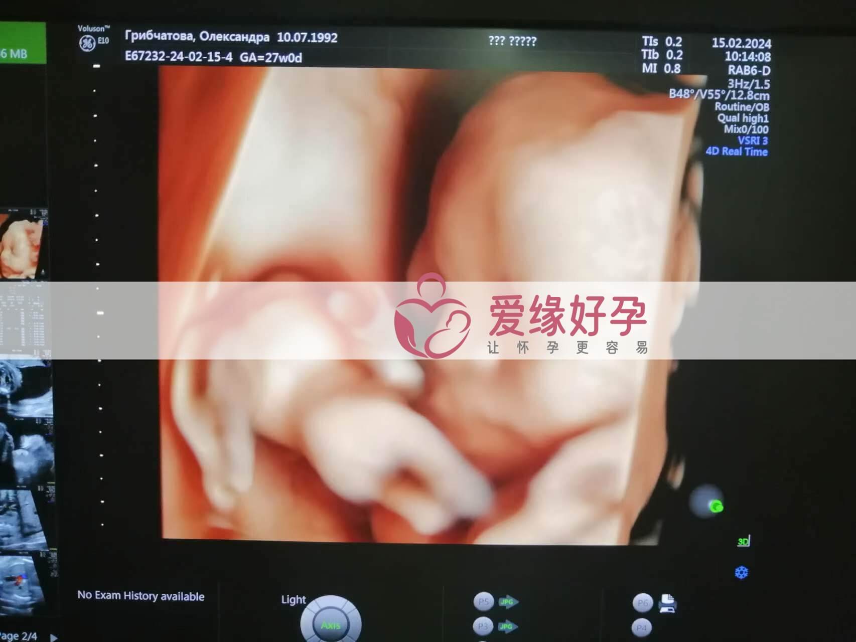 代孕代孕代母27周产检顺利通过