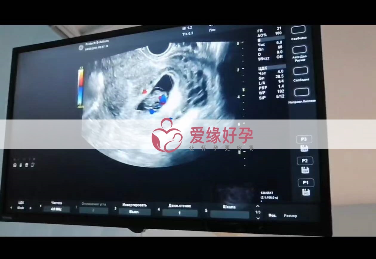 代孕代孕代母9周孕检通过
