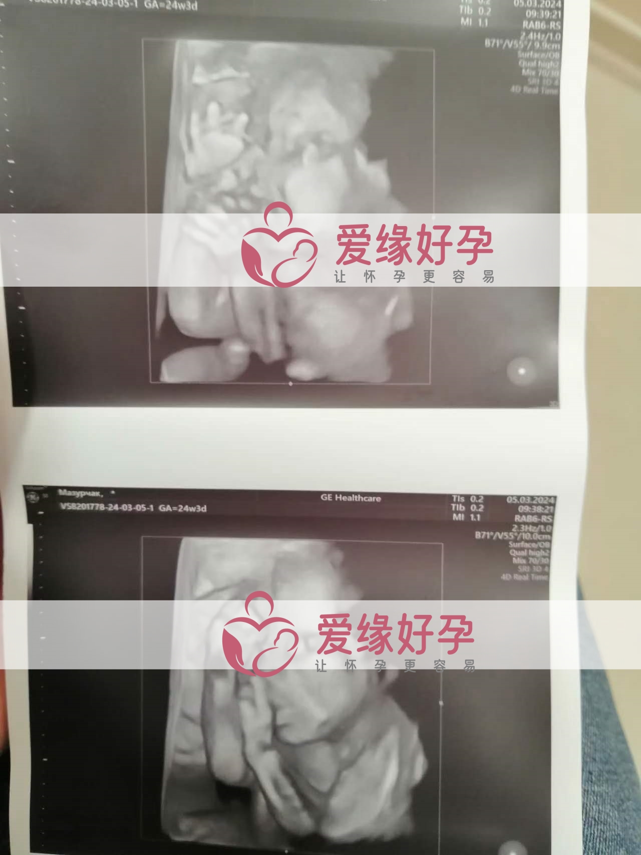 代孕代孕代母24周产检顺利通过