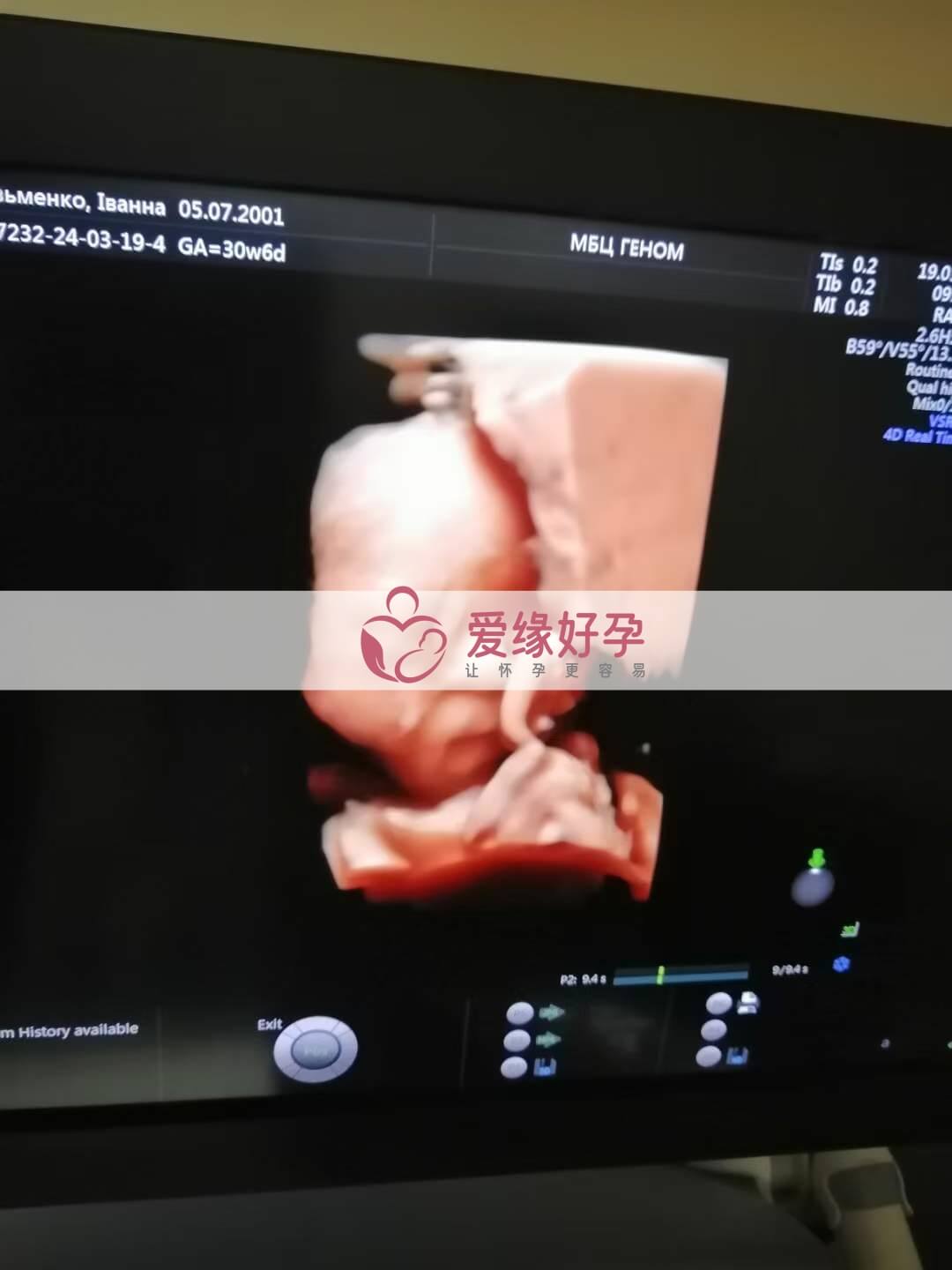 代孕代孕代母30周产检顺利通过