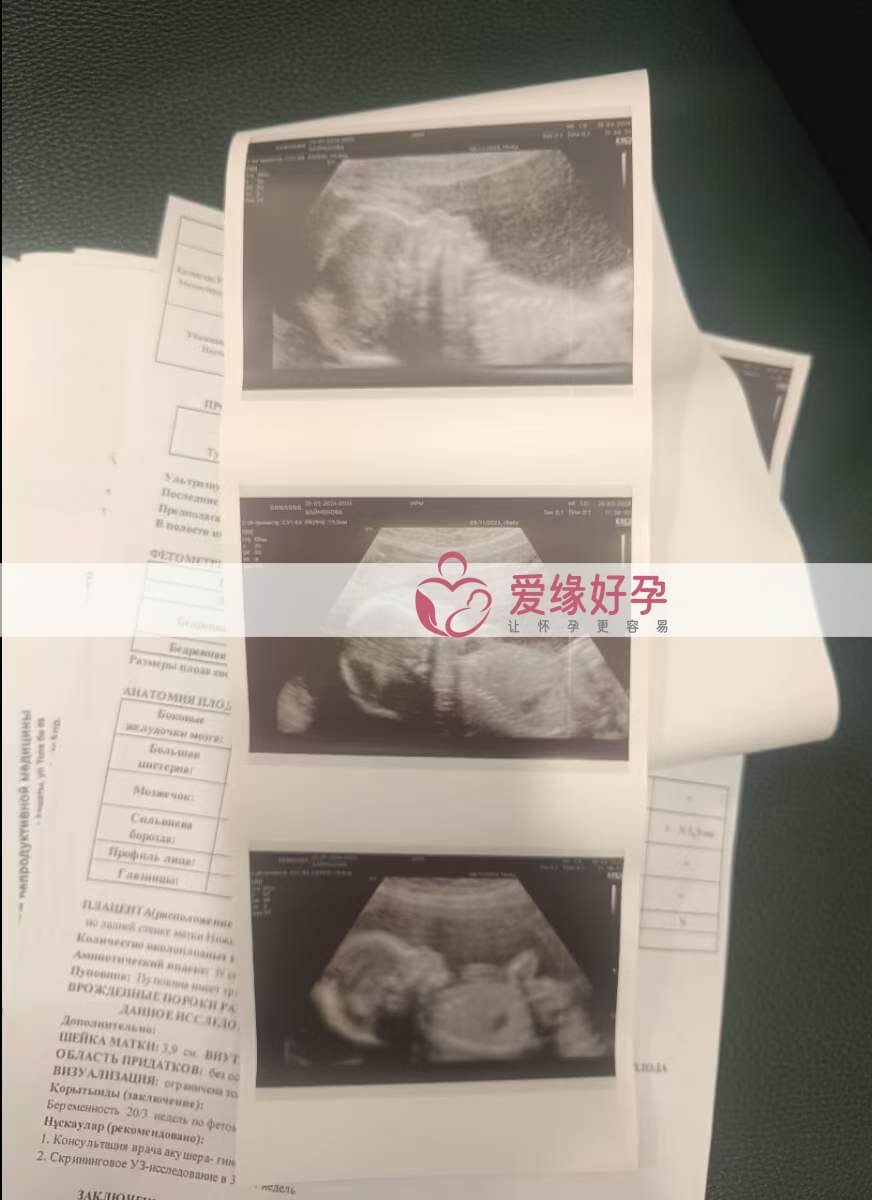 代孕代孕代母20周孕检顺利通过！
