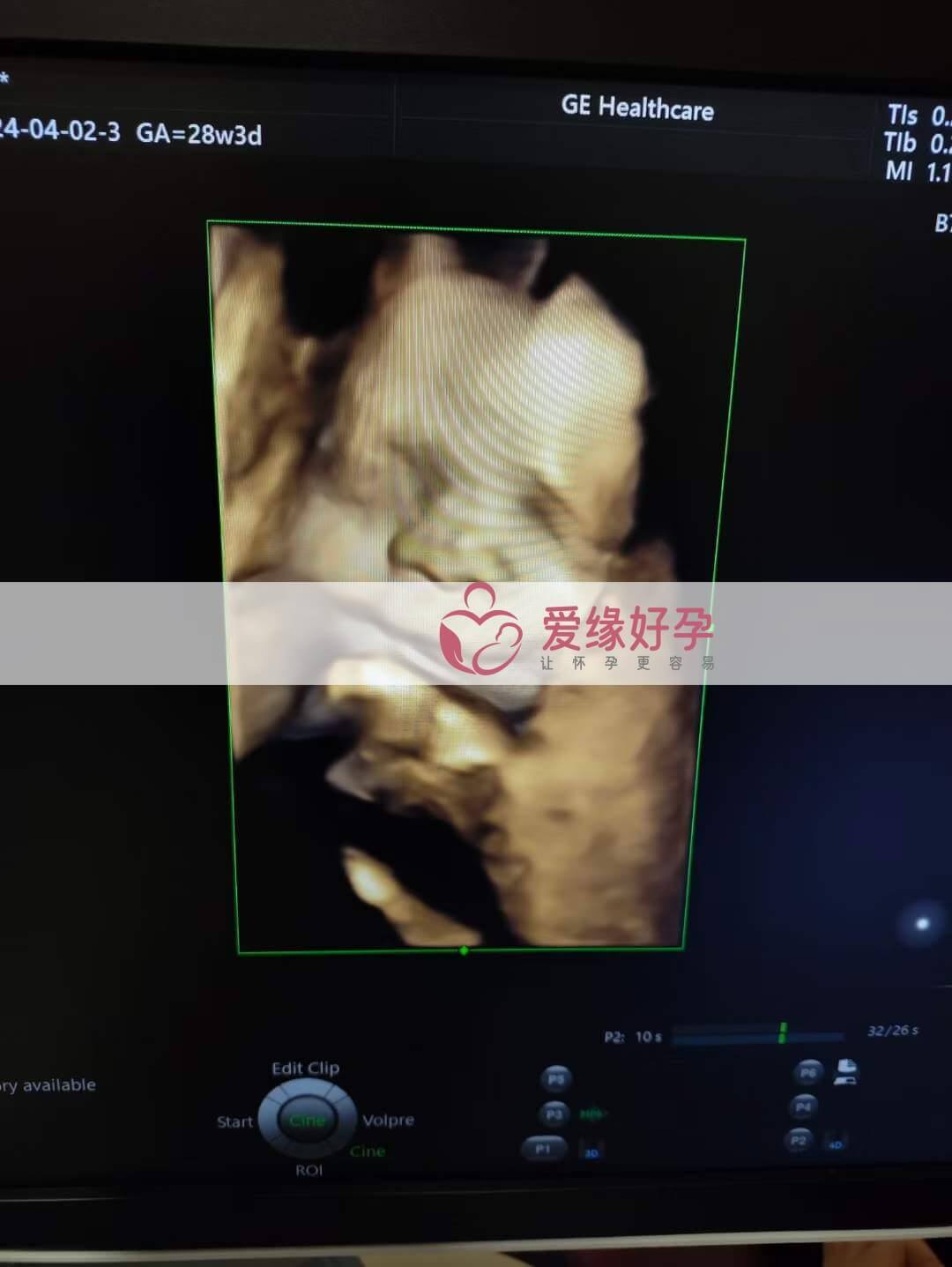 代孕代孕代母28周孕检顺利通过！