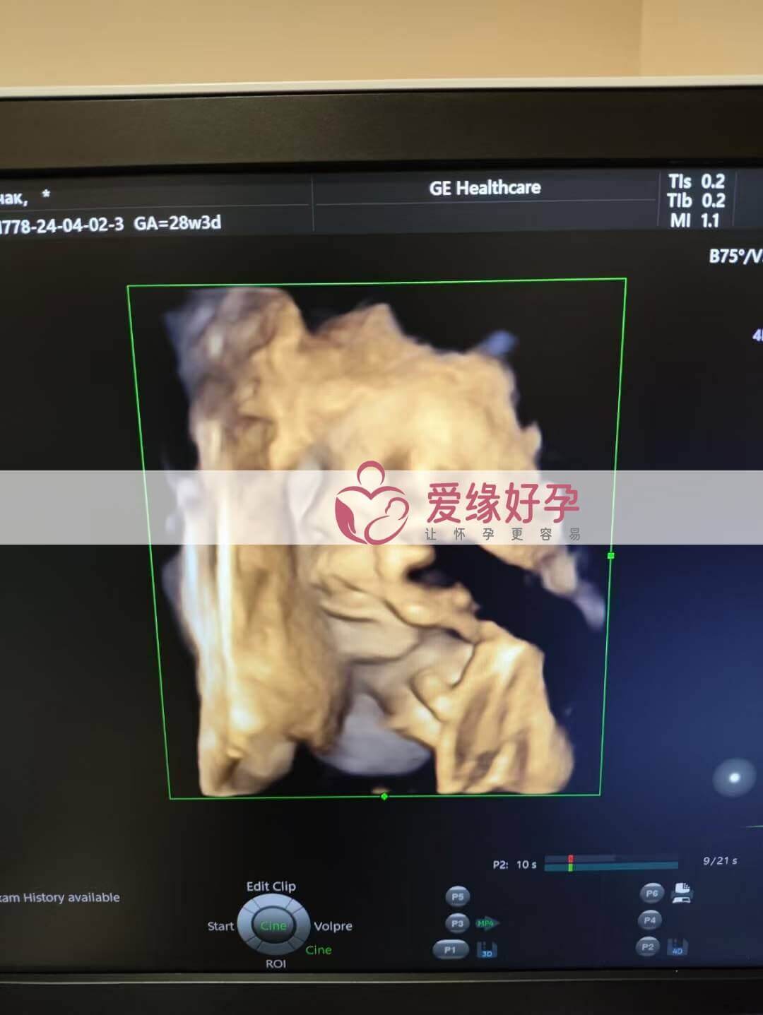 代孕代孕代母28周孕检顺利通过！