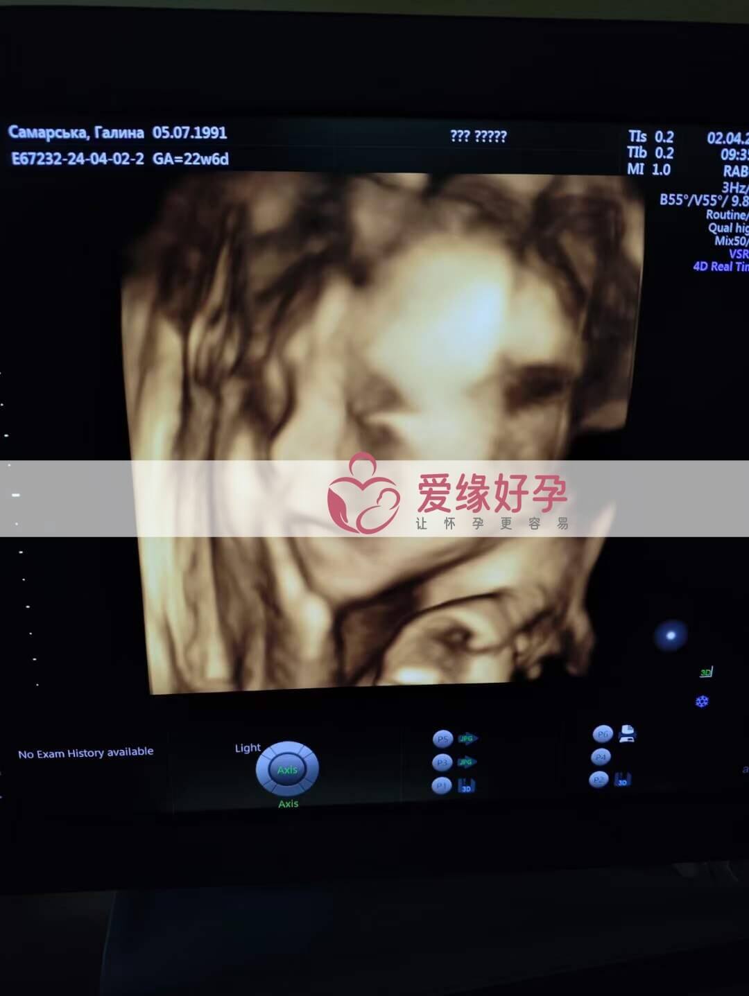 代孕代孕代母22周孕检顺利通过！