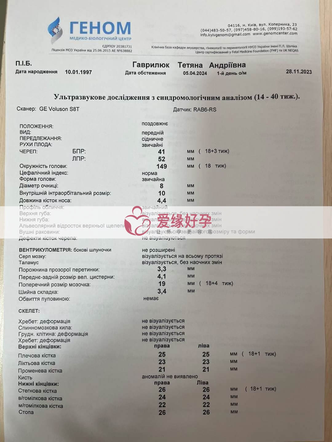 代孕代孕代母18周孕检顺利通过！