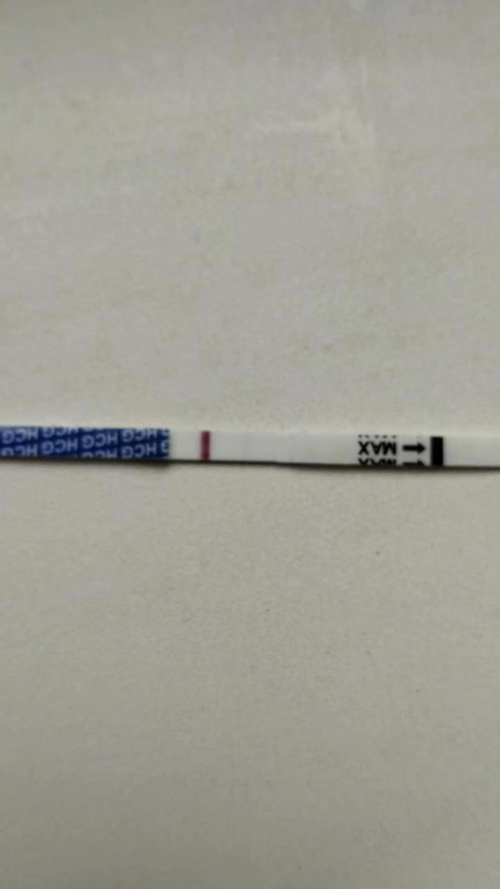 爱缘好孕:试管婴儿助代母妈移植第7天尿检双杠啦~