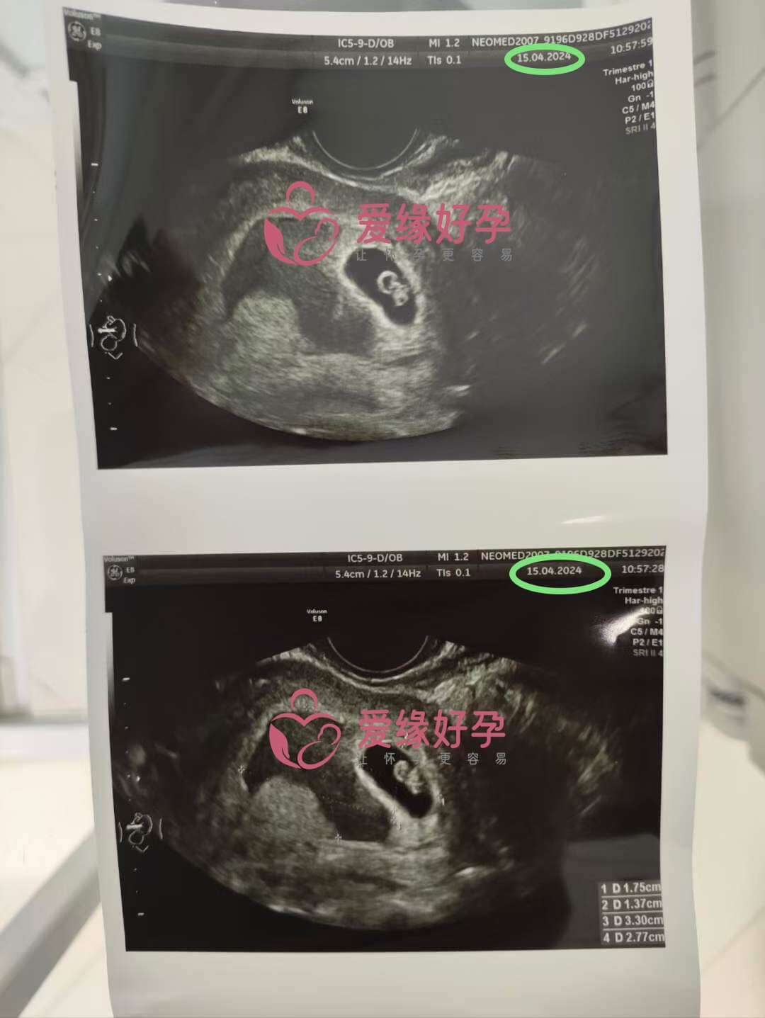 爱缘好孕:我们的代孕代母6周产检顺利通过！