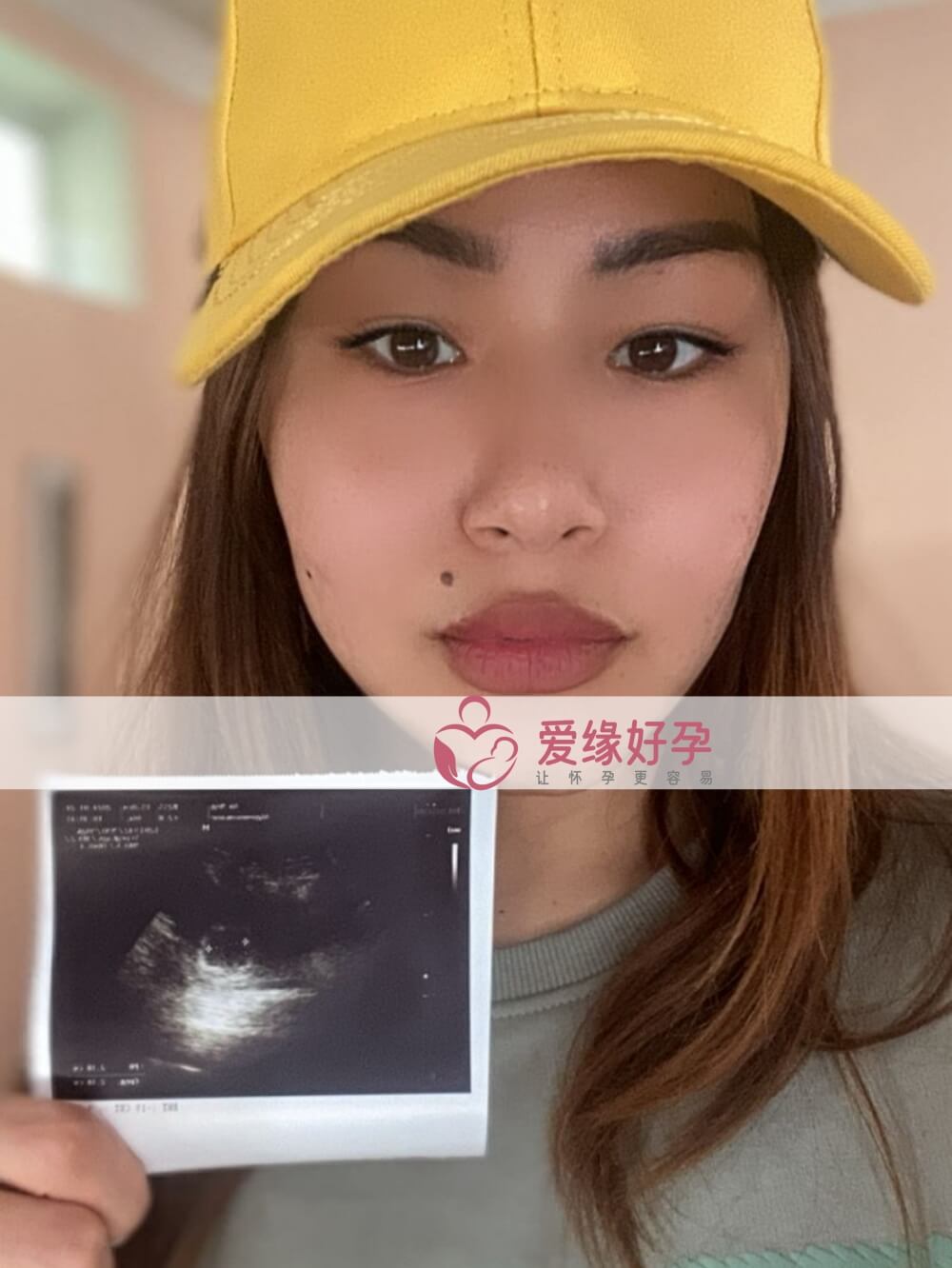 爱缘好孕:哈萨克斯坦代孕代孕代母第一次B超通过
