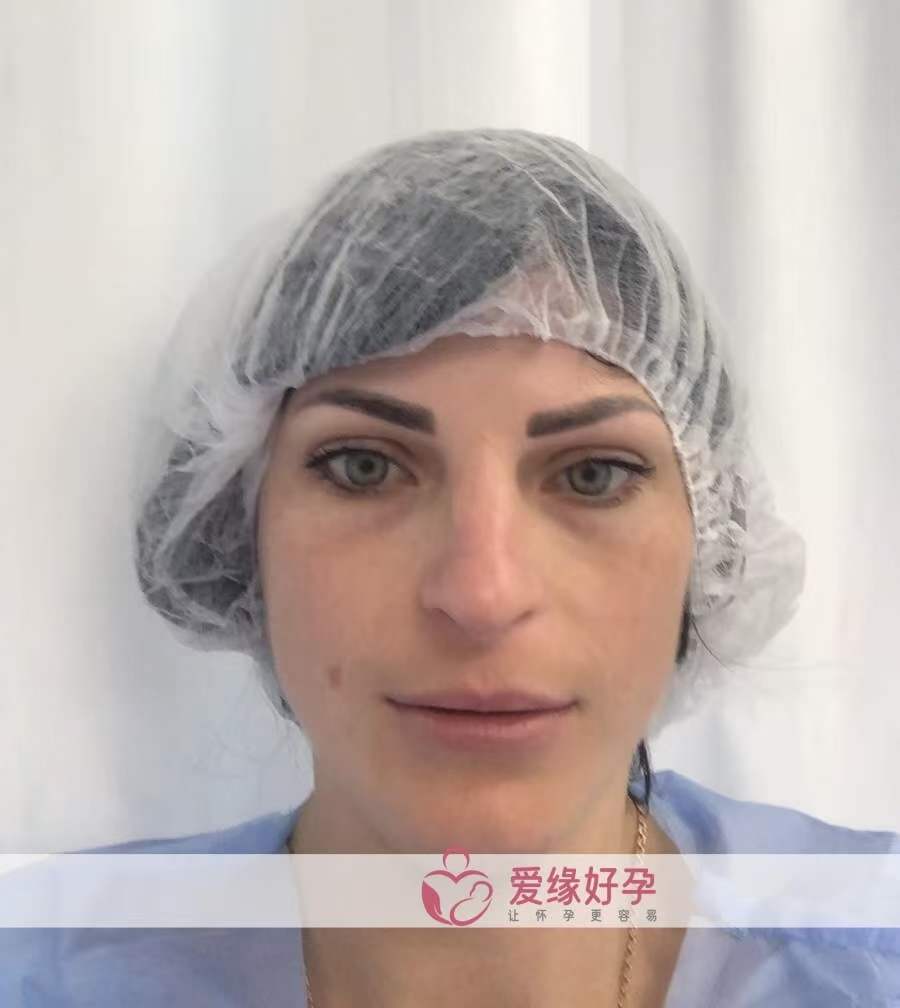 爱缘好孕：乌克兰代孕代母今天移植了2颗囊胚