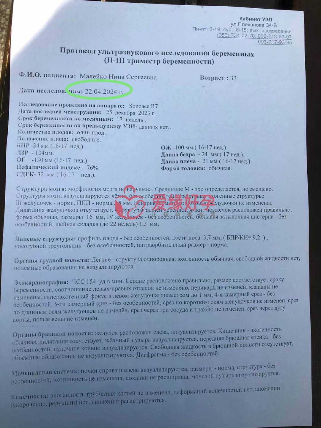 爱缘好孕：乌克兰的代孕代母孕16周产检顺利通过拉